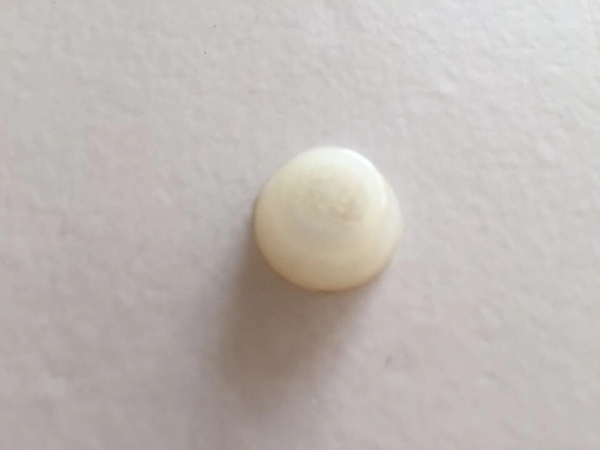 注塑加工